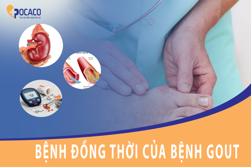 benh-dong-thoi-va-nhung-thuc-pham-danh-rieng-cho-benh-gout-1