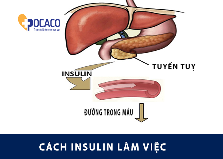 benh-tieu-duong-loai-nhung-cach-ngan-chan-&-cai-thien-tinh-thang-khang-insulin-3