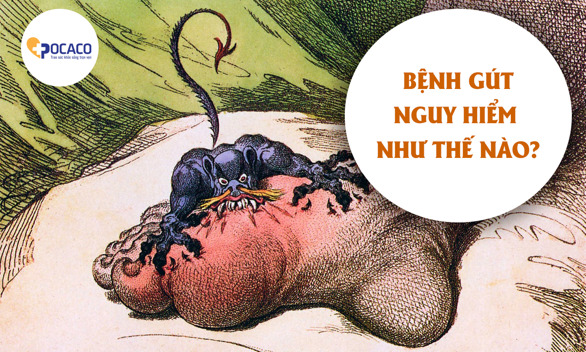benh-gut-nguy-hiem-nhu-the-nao-1