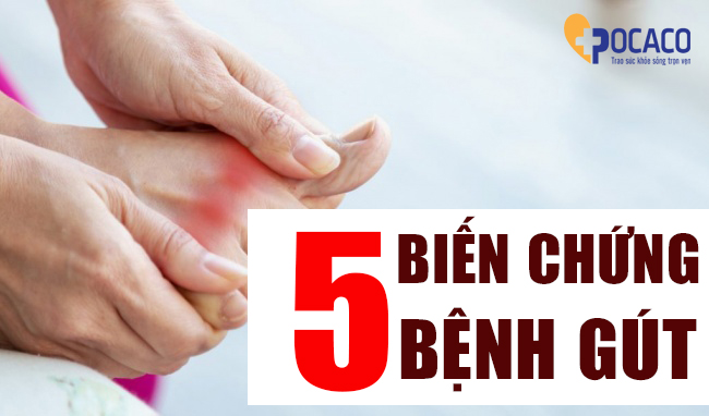 5-bien-chung-benh-gut-ban-can-biet-1