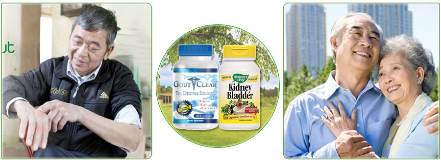 cac-trieu-chung-benh-gout-la-gi-lam-the-nao-de-phong-ngua-va-dieu-tri-4