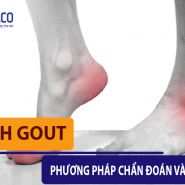 [ Bệnh Gout ] Phương pháp chẩn đoán và điều trị bạn không thể bỏ qua