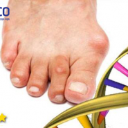 Di truyền là gì? Bệnh gout có di truyền hay không?