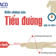 [THỐNG KÊ] Những biến chứng thường gặp của bệnh tiểu đường bạn không được bỏ qua