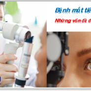 Bệnh tiểu đường & vấn đề giảm thị lực - 4 bệnh mắt do tiểu đường